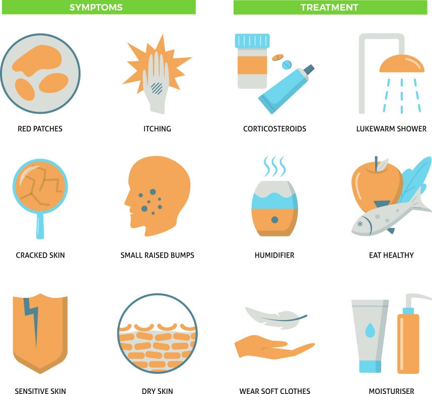 Atopic Dermatitis Atopic Dermatitis