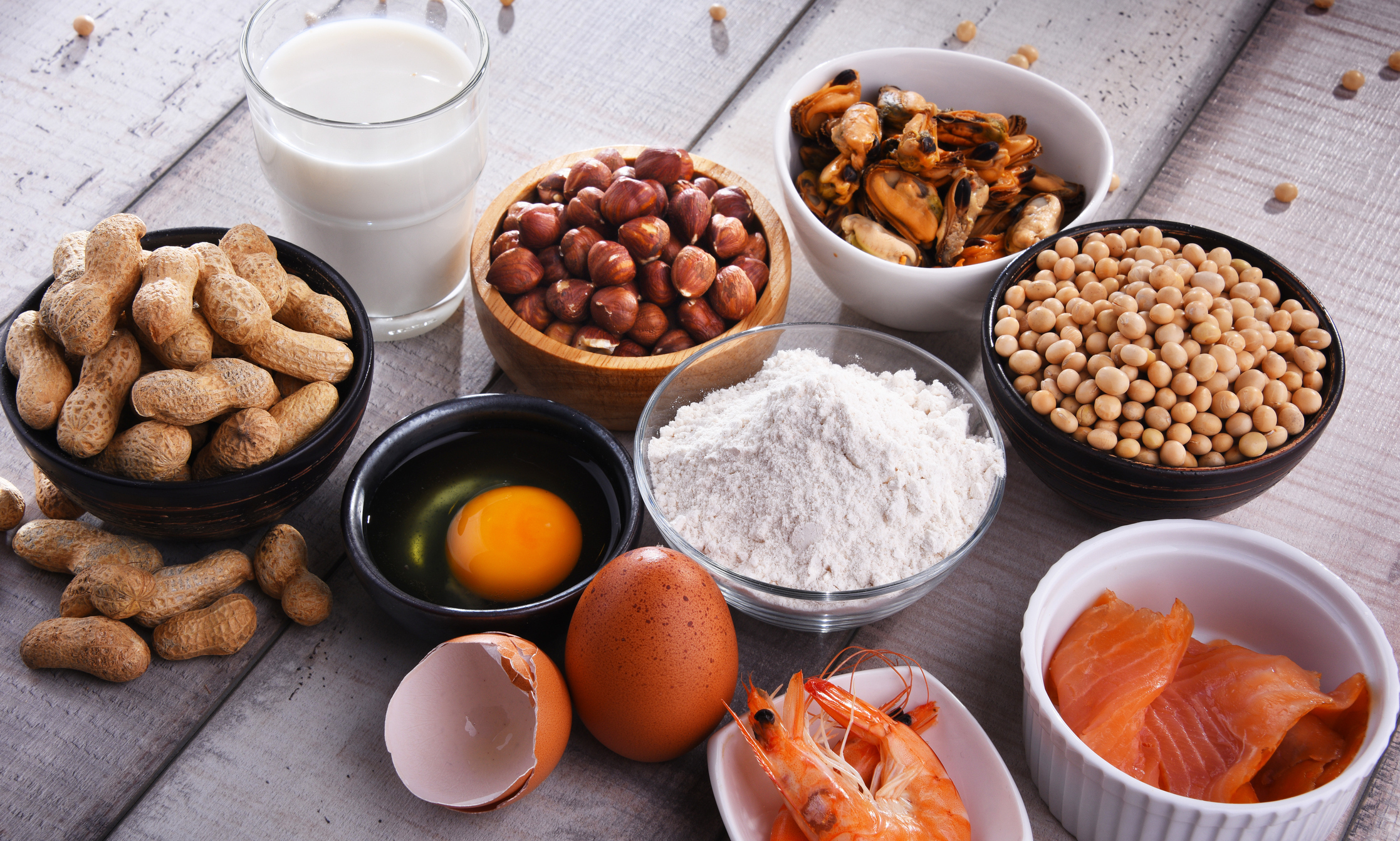 Food Allergy Guide: Symptoms, Testing, Diagnosis & Treatment